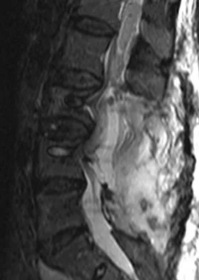 Spine Surgery 2009 Practice Questions: Set 3 (Solved) - Figure 13