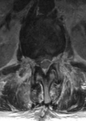 Spine Surgery 2009 Practice Questions: Set 3 (Solved) - Figure 14