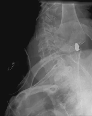 Spine Surgery 2009 Practice Questions: Set 3 (Solved) - Figure 16