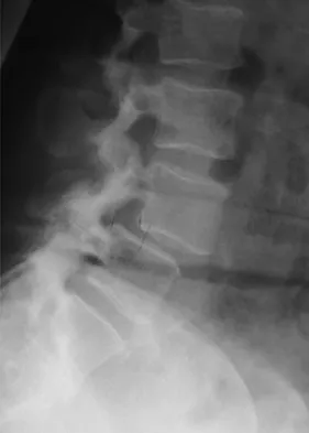 Spine Surgery 2009 Practice Questions: Set 3 (Solved) - Figure 2