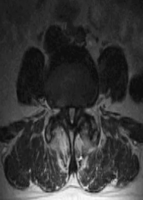 Spine Surgery 2009 Practice Questions: Set 3 (Solved) - Figure 3
