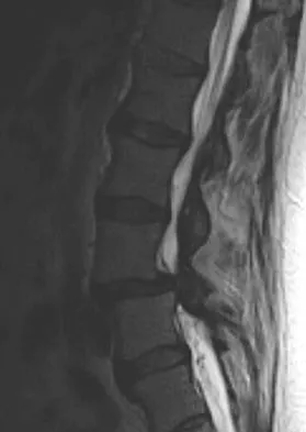 Spine Surgery 2009 Practice Questions: Set 3 (Solved) - Figure 4