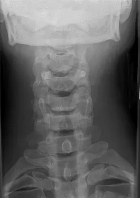 Spine Surgery 2009 Practice Questions: Set 3 (Solved) - Figure 5
