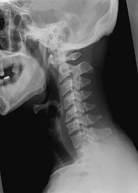 Spine Surgery 2009 Practice Questions: Set 3 (Solved) - Figure 6