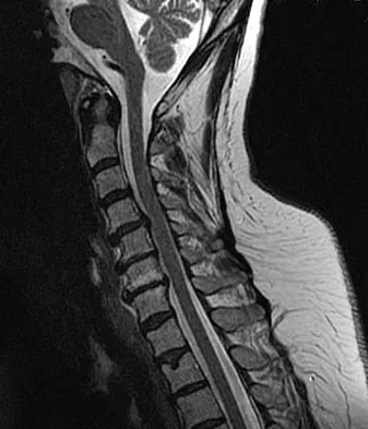 Spine Surgery 2009 Practice Questions: Set 3 (Solved) - Figure 9