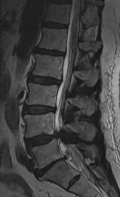 AAOS & ABOS Spine MCQs (Set 4): Trauma, Degenerative & Deformity | Board Prep