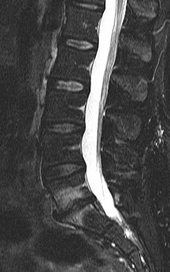 Spine Surgery Board Review 2009: High-Yield MCQs (Set 4) - Figure 11