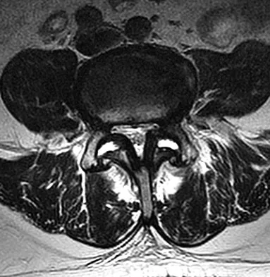 Spine Surgery Board Review 2009: High-Yield MCQs (Set 4) - Figure 2