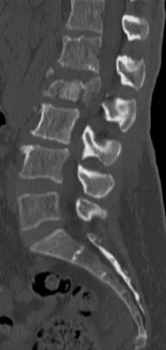 Spine Surgery Board Review 2009: High-Yield MCQs (Set 4) - Figure 7