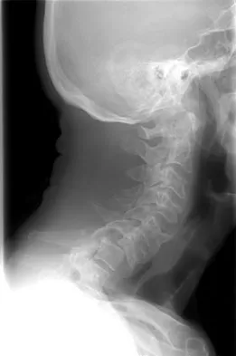 Spine Surgery Board Review 2009: High-Yield MCQs (Set 4) - Figure 8