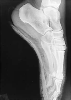 Sports Medicine 2001 Practice Questions: Set 1 (Solved) - Figure 11