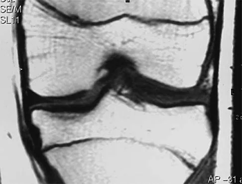 Sports Medicine 2001 Practice Questions: Set 1 (Solved) - Figure 2