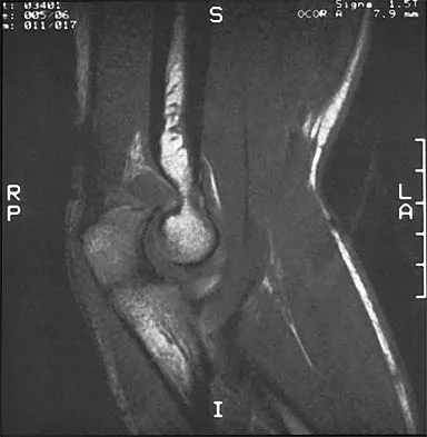 Sports Medicine 2001 Practice Questions: Set 1 (Solved) - Figure 24