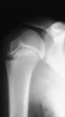 Sports Medicine 2001 Practice Questions: Set 1 (Solved) - Figure 31