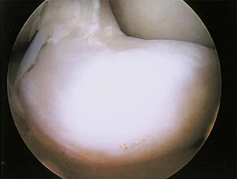 Sports Medicine 2001 Practice Questions: Set 1 (Solved) - Figure 6