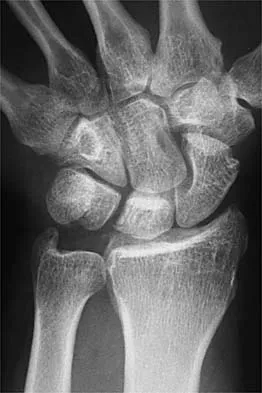 Click to enlarge Sports Medicine 2001 Practice Questions: Set 1 (Solved) - Figure 7