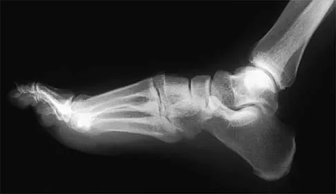 Sports Medicine 2001 Practice Questions: Set 1 (Solved) - Figure 9