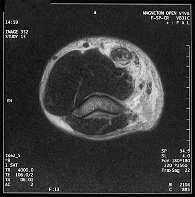 Sports Medicine Board Review 2001: High-Yield MCQs (Set 2) - Figure 12