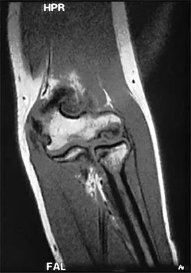 Sports Medicine Board Review 2001: High-Yield MCQs (Set 2) - Figure 18