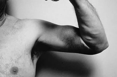 Sports Medicine Board Review 2001: High-Yield MCQs (Set 2) - Figure 2