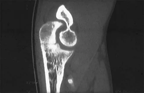 Sports Medicine Board Review 2001: High-Yield MCQs (Set 2) - Figure 24