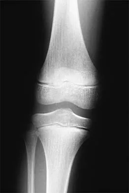Sports Medicine 2001 Practice Questions: Set 3 (Solved) - Figure 1