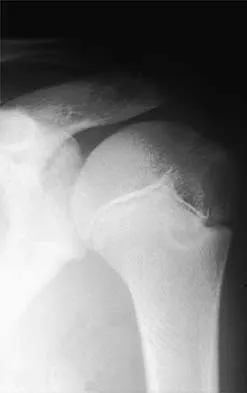 Sports Medicine 2001 Practice Questions: Set 3 (Solved) - Figure 3