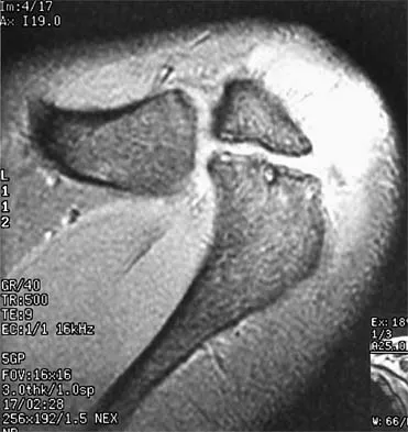 Sports Medicine 2001 Practice Questions: Set 3 (Solved) - Figure 8