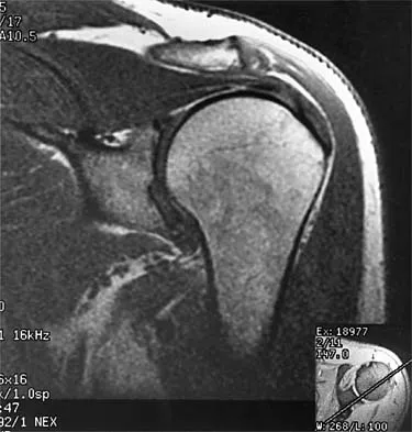 Sports Medicine 2001 Practice Questions: Set 3 (Solved) - Figure 9