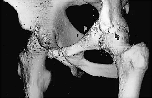 Master Magnetic Resonance Image MCQs for Orthopedic Exams