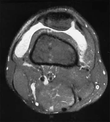 Sports Medicine Board Review 2001: High-Yield MCQs (Set 4) - Figure 9