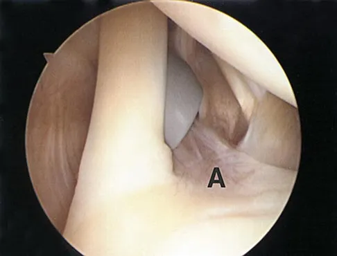 Sports Medicine 2004 Practice Questions: Set 1 (Solved) - Figure 15