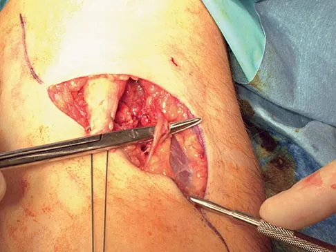 Sports Medicine 2004 Practice Questions: Set 1 (Solved) - Figure 16