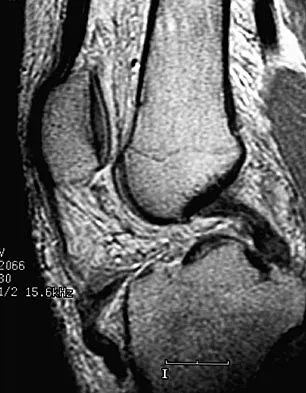 Sports Medicine 2004 Practice Questions: Set 1 (Solved) - Figure 17