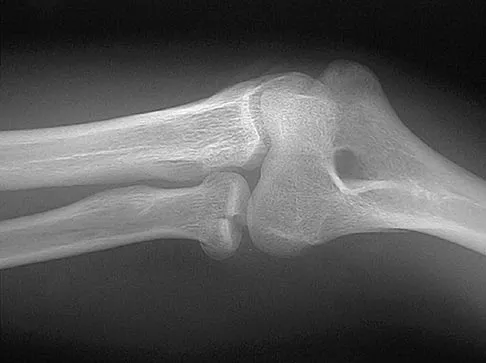 Sports Medicine 2004 Practice Questions: Set 1 (Solved) - Figure 2