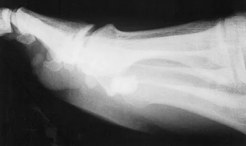 Sports Medicine 2004 Practice Questions: Set 1 (Solved) - Figure 22