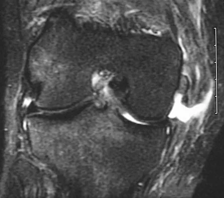 Sports Medicine 2004 Practice Questions: Set 1 (Solved) - Figure 24