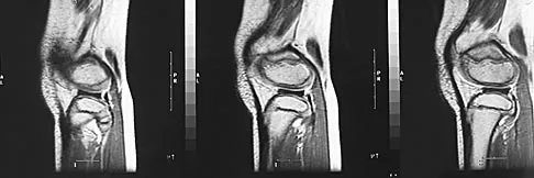 Sports Medicine 2004 Practice Questions: Set 1 (Solved) - Figure 27