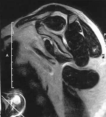 Sports Medicine 2004 Practice Questions: Set 1 (Solved) - Figure 5