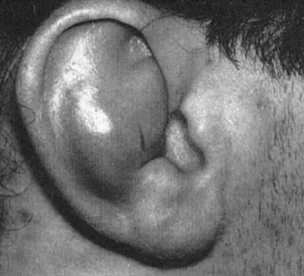 Sports Medicine 2004 Practice Questions: Set 1 (Solved) - Figure 8