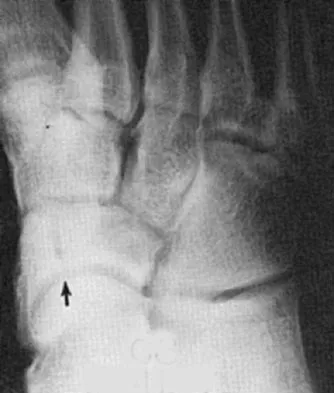 Sports Medicine Board Review 2004: High-Yield MCQs (Set 2) - Figure 12