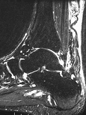 Sports Medicine Board Review 2004: High-Yield MCQs (Set 2) - Figure 16