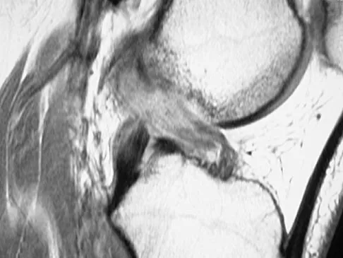 Sports Medicine Board Review 2004: High-Yield MCQs (Set 2) - Figure 20