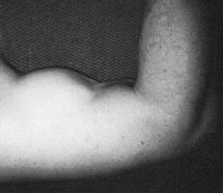 Sports Medicine Board Review 2004: High-Yield MCQs (Set 2) - Figure 5