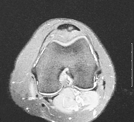 Sports Medicine 2004 MCQs - Part 3