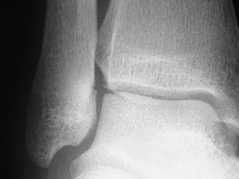 Sports Medicine 2004 Practice Questions: Set 3 (Solved) - Figure 11
