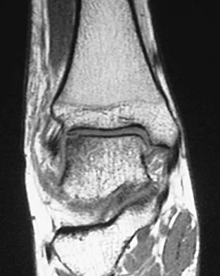 Sports Medicine 2004 Practice Questions: Set 3 (Solved) - Figure 13