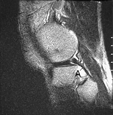 Sports Medicine 2004 Practice Questions: Set 3 (Solved) - Figure 15