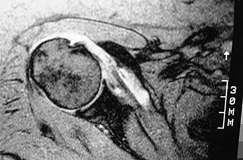 Sports Medicine 2004 Practice Questions: Set 3 (Solved) - Figure 17