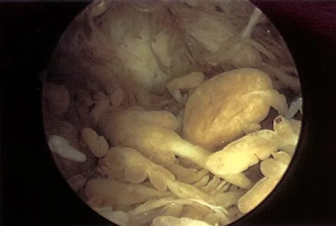 Sports Medicine 2004 Practice Questions: Set 3 (Solved) - Figure 2